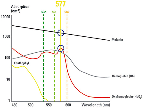 Lenovo IdeaPad Y510p teszt
